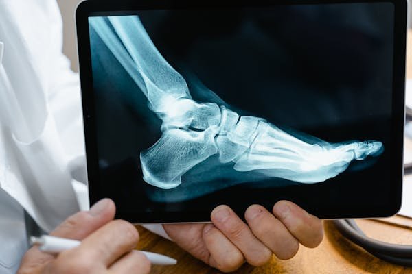 Découvrez notre boutique en ligne de solutions orthopédiques